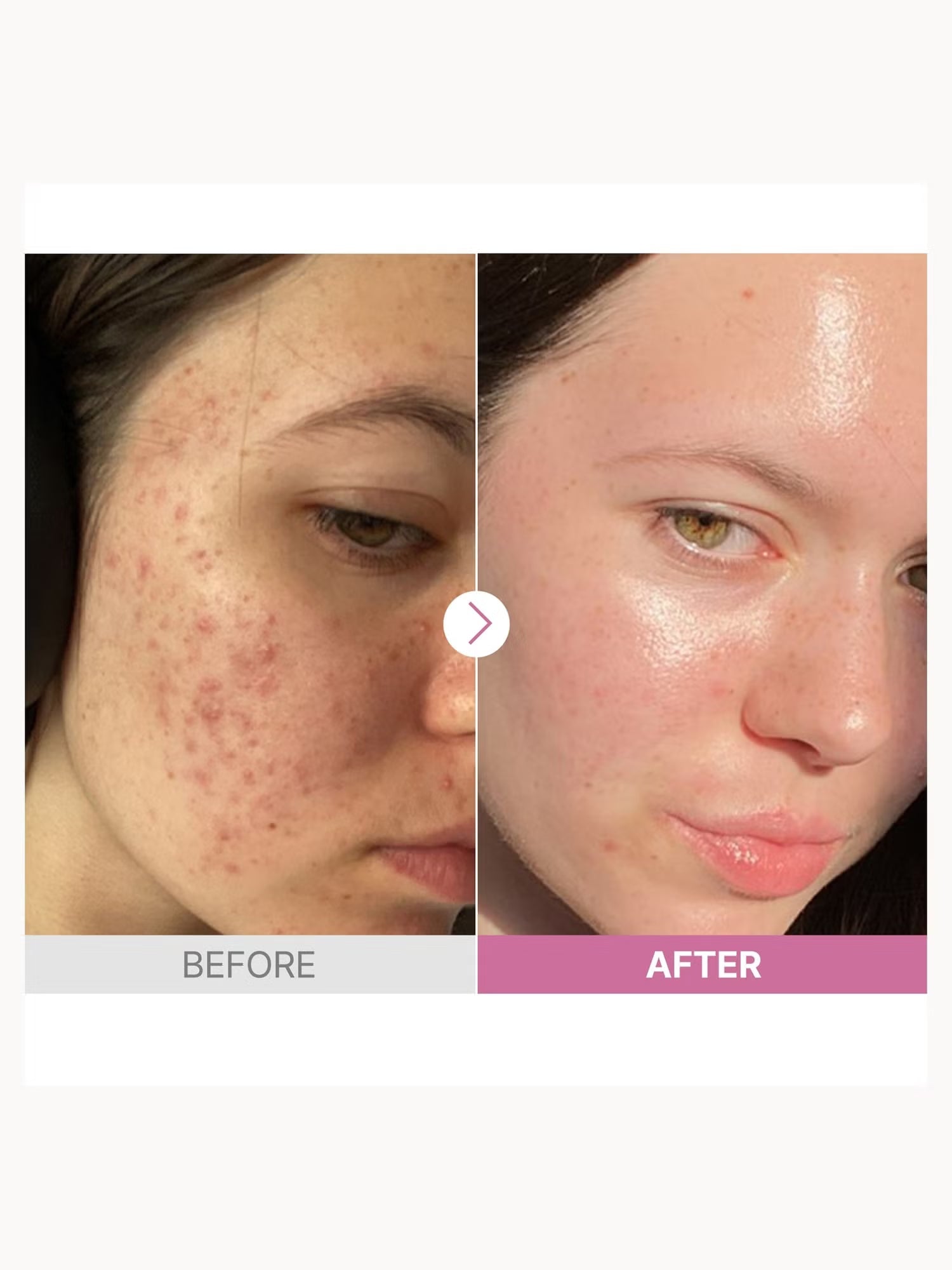 COSRX The Niacinamide 15 Serum 20ml